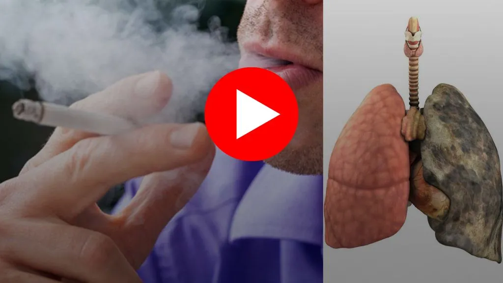 Blue light eye damage